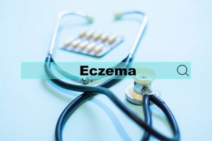 phototherapy for eczema