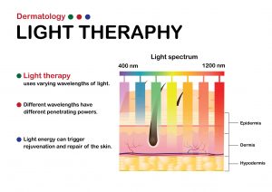 phototherapy for skin disorders