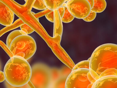 Does UV Light Kill Candida Auris?