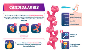 Does UV Light Kill Candida Auris? 2